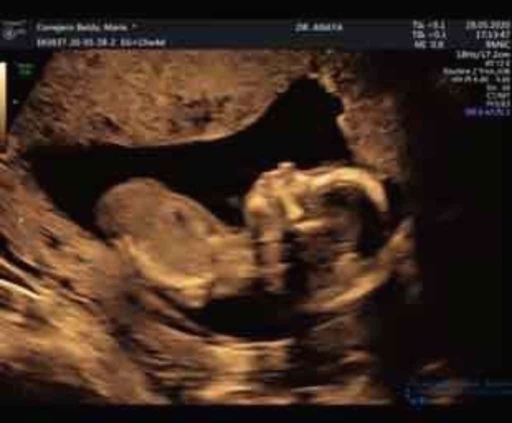 Día 16: It's a boy!