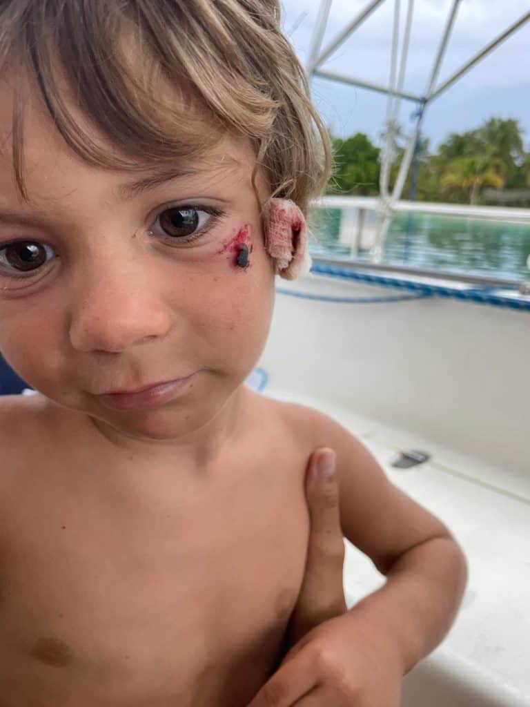 Erik, tras regresar del centro de salud.
